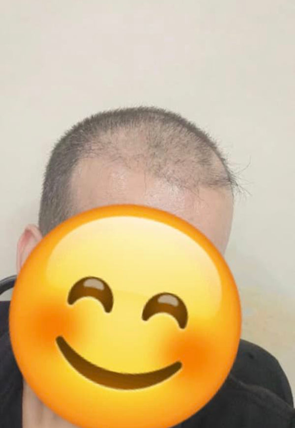 Before