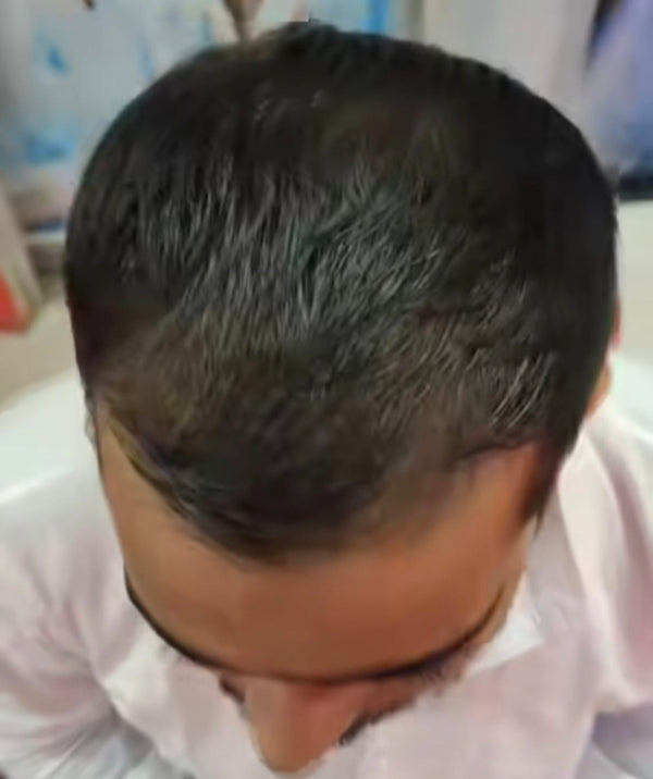 After