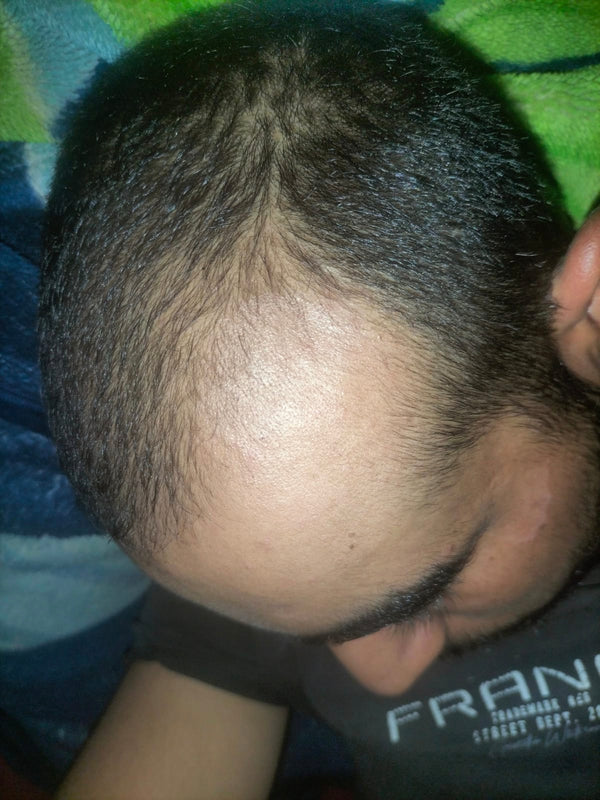 Before